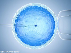 关于景泰生殖